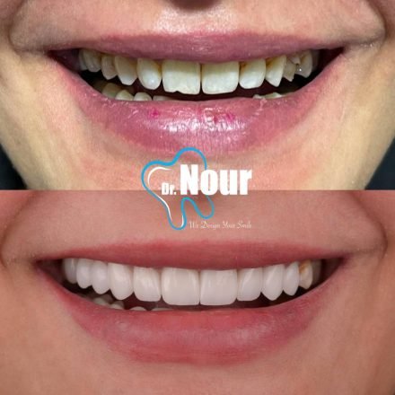 276059628_527649108723741_4772346136623764761_n-958x1024